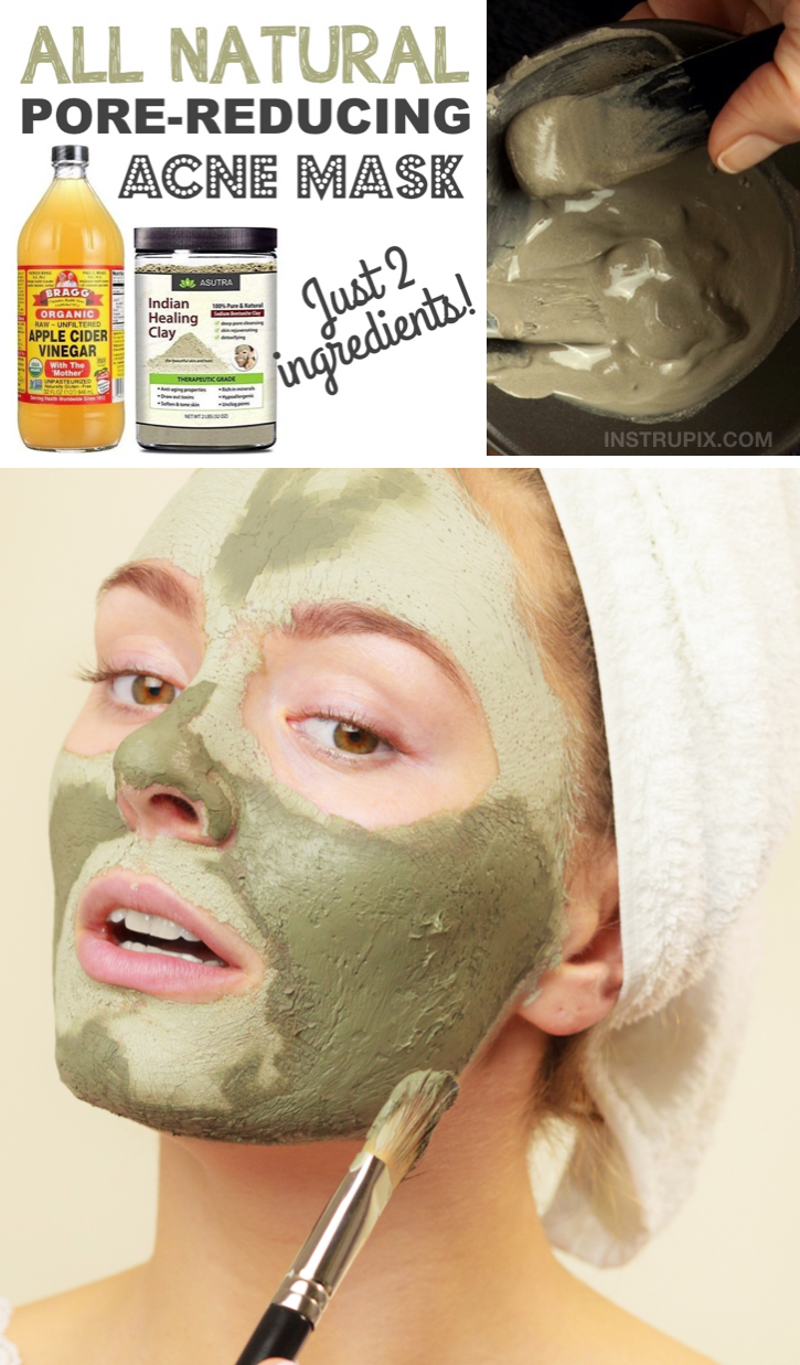 Looking for fast homemade acne remedies? This DIY face mask is made with just 2 natural ingredients! Apple cider vinegar and Indian Healing Clay. 